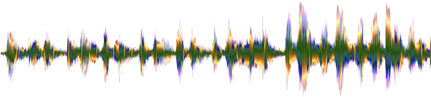 Sound Acoustic Wave Hearing - Clip Art Sound Waves (1501x340)