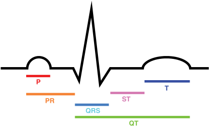File - Ecg Intervals - Svg - Sa Node Damage On Ecg (473x281)