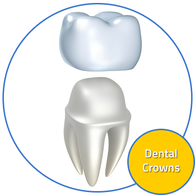 Custom Dental Offers Dental Crowns - Protesis Dental (400x400)