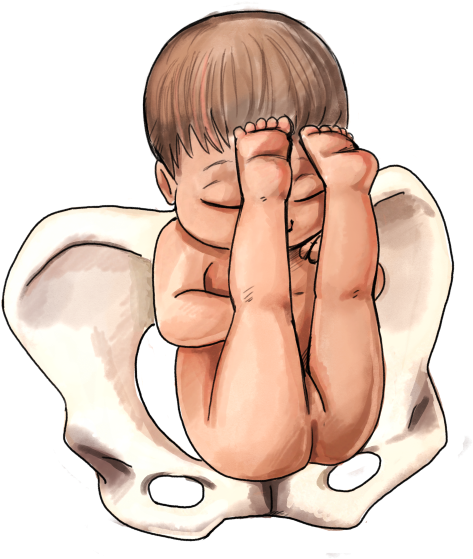 Frank Breech Baby - Frank Breech Baby (500x647)