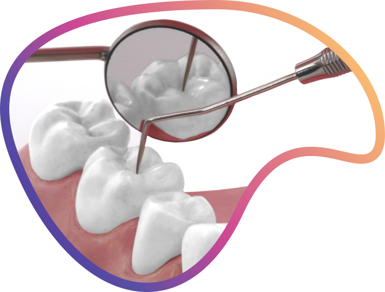 As Tooth Decay And Gum Disease - As Tooth Decay And Gum Disease (789x599)