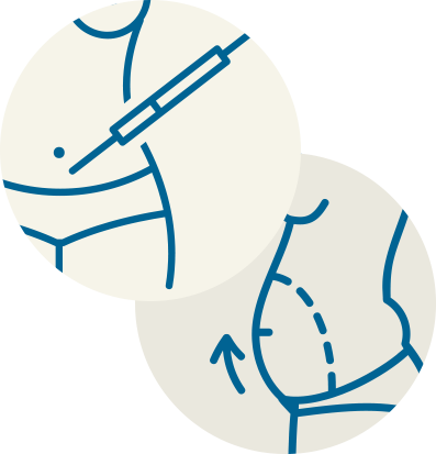 Tummy Tuck Surgery And Liposuction Are Similar In That - Tummy Tuck Surgery And Liposuction Are Similar In That (397x413)