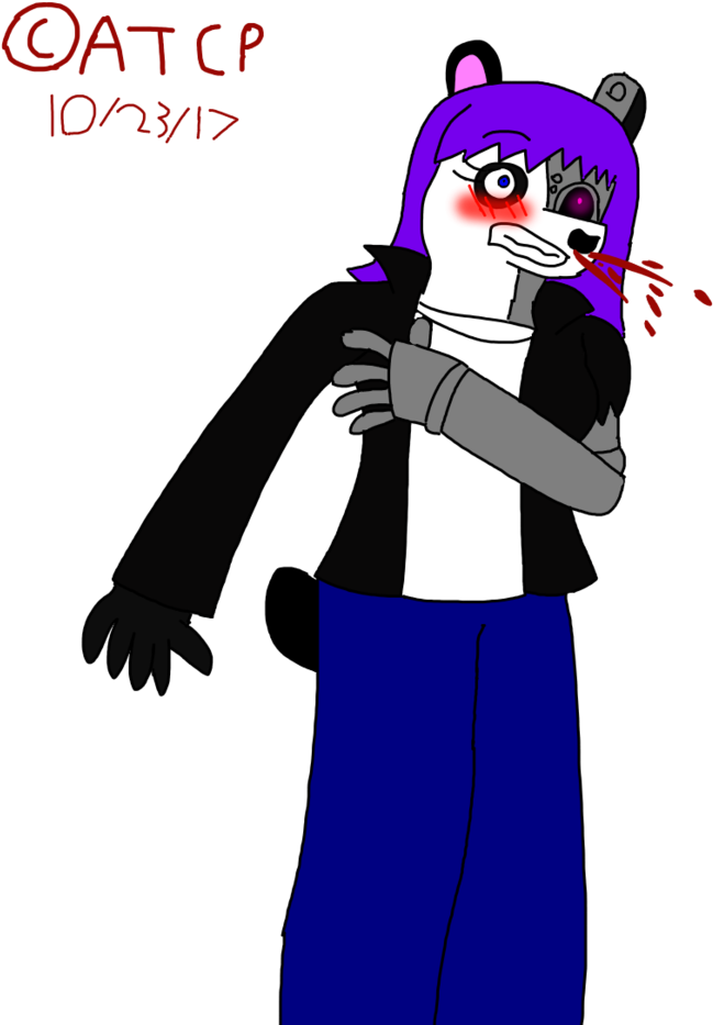 Injury Clipart Bruised - Injury Clipart Bruised (847x942)