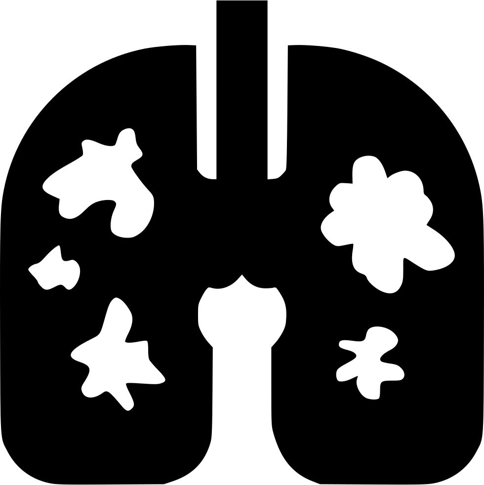 Cancer Of Lung Comments - Cancer Of Lung Comments (980x982)