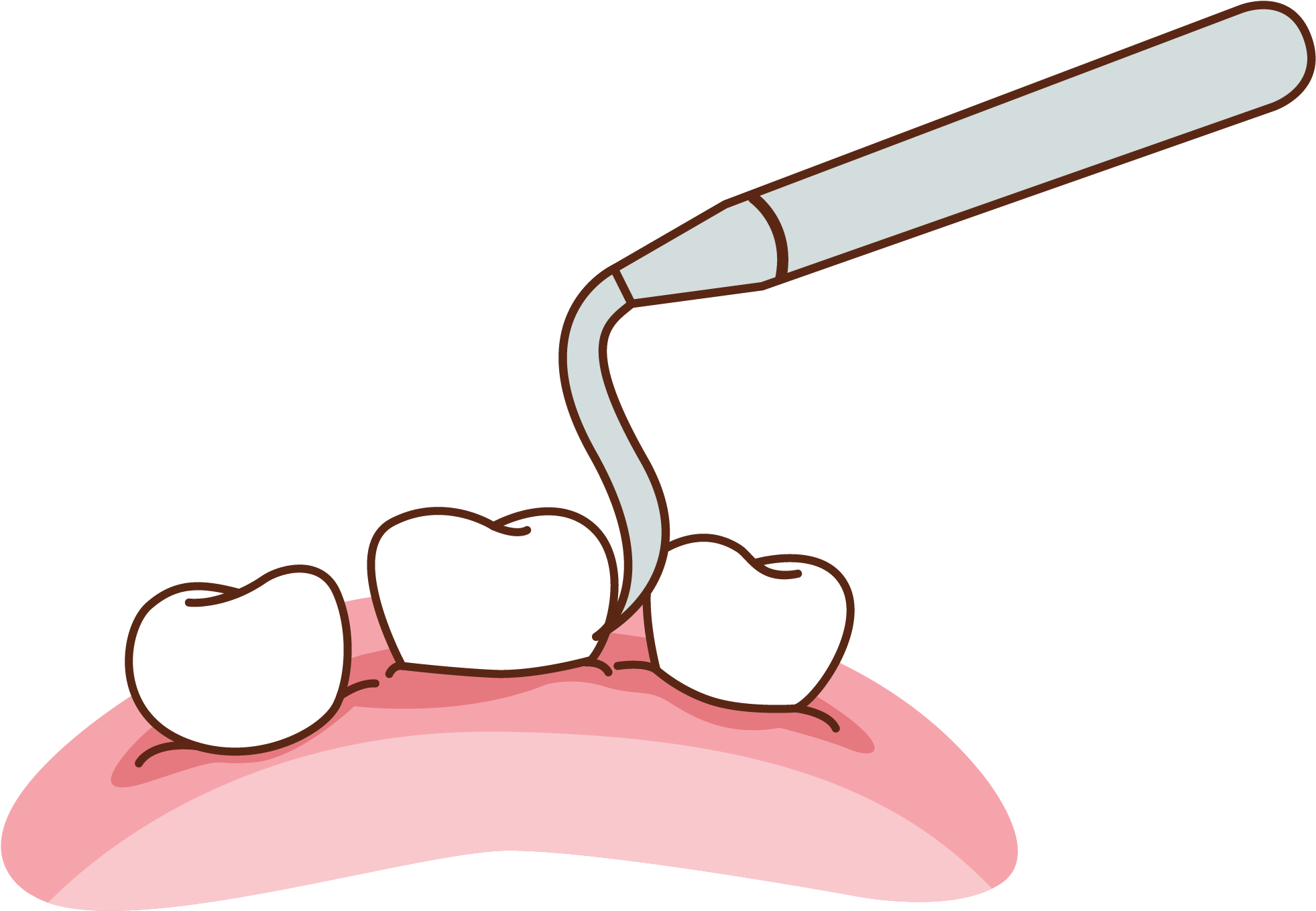 Dentures - Dentures (2084x2085)