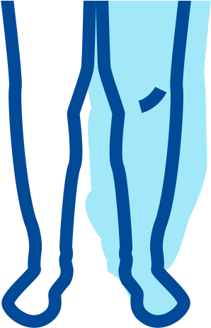 Lymphedema Treatment - Lymphedema Treatment (715x462)