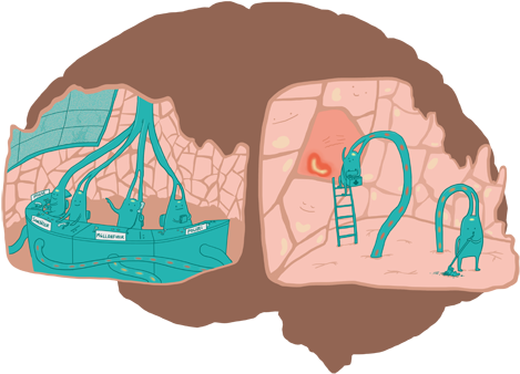 Microglial Cells Are First On The Scene To Fix The - Microglial Cells Are First On The Scene To Fix The (540x360)