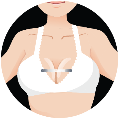 Banner Free Download Bridge Reduce Sagging Bouncing - Banner Free Download Bridge Reduce Sagging Bouncing (413x413)