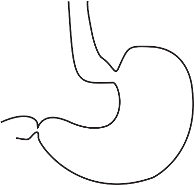 This Brochure Is Not Intended To Take The Place Of - This Brochure Is Not Intended To Take The Place Of (399x381)