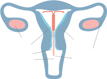 Interactive Uterus - Interactive Uterus (430x312)