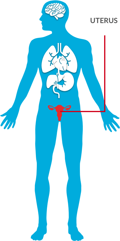 Robotic Assisted Hysterectomy - Robotic Assisted Hysterectomy (447x848)