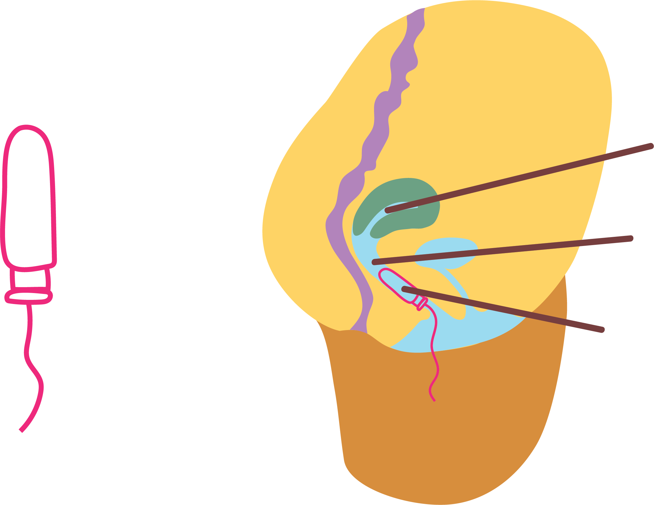 Uterus - Uterus (2210x1706)