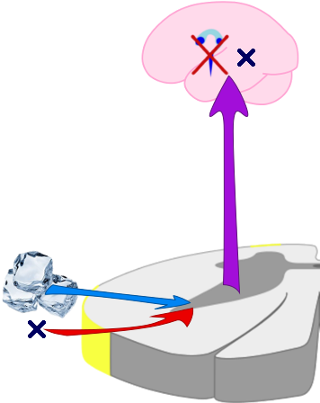 Heat At The Trigger Point Eliminates Pain And Brings - Heat At The Trigger Point Eliminates Pain And Brings (359x457)