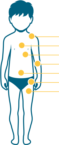 Clip Art Transparent Stock Duchenne Muscular Dystrophy - Clip Art Transparent Stock Duchenne Muscular Dystrophy (319x554)