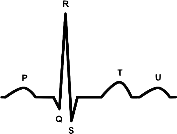 Ecg Waveform - Promedcert - Ecg Waveform - Promedcert (605x462)