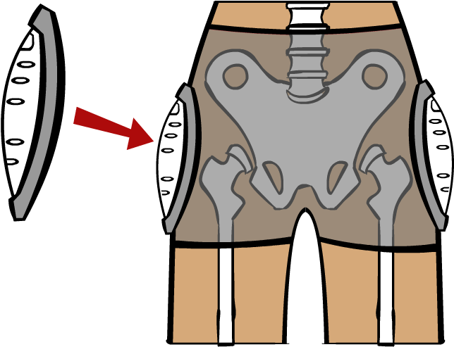 Hip Protectors Are Commonly Used By Seniors Who Have - Hip Protectors Are Commonly Used By Seniors Who Have (738x578)