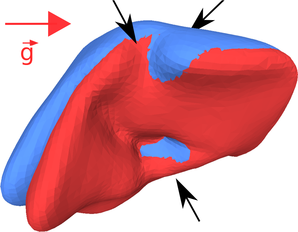 Atlas-based Transfer Of Boundary Conditions For Biomechanical - Atlas-based Transfer Of Boundary Conditions For Biomechanical (1066x805)