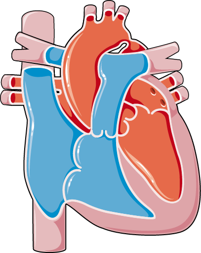 Congenital Heart Diseases Coarctation Of The Aorta - Congenital Heart Diseases Coarctation Of The Aorta (407x511)