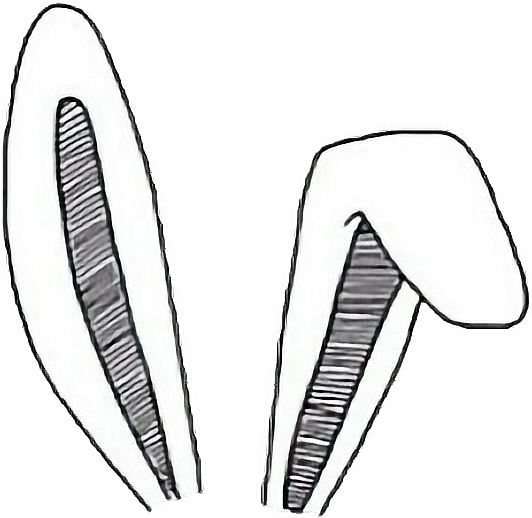 Tumblrgirl Ears Bunnyears Cute - Tumblrgirl Ears Bunnyears Cute (532x518)