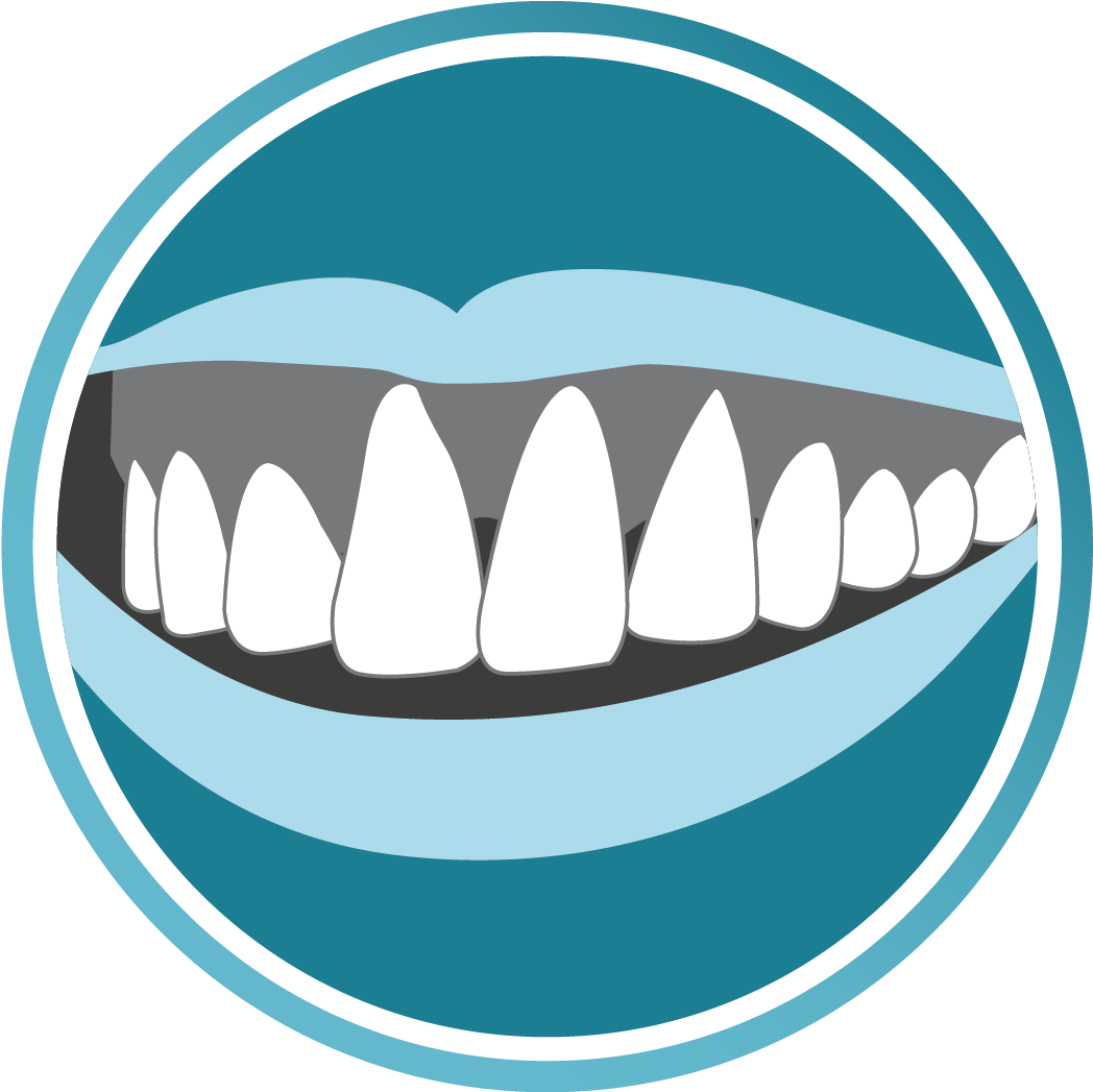 Don't Ignore Bleeding Gums And Gum Problems - Don't Ignore Bleeding Gums And Gum Problems (1145x1046)