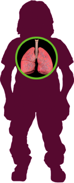 A Way People With Morquio Syndrome May Die, Is When - A Way People With Morquio Syndrome May Die, Is When (237x585)