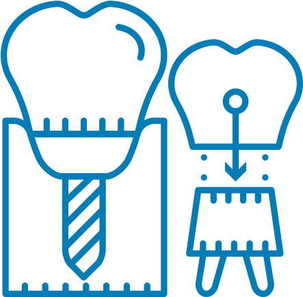 Multiple And Single Tooth Implants Bloomingdale Il - Multiple And Single Tooth Implants Bloomingdale Il (480x480)