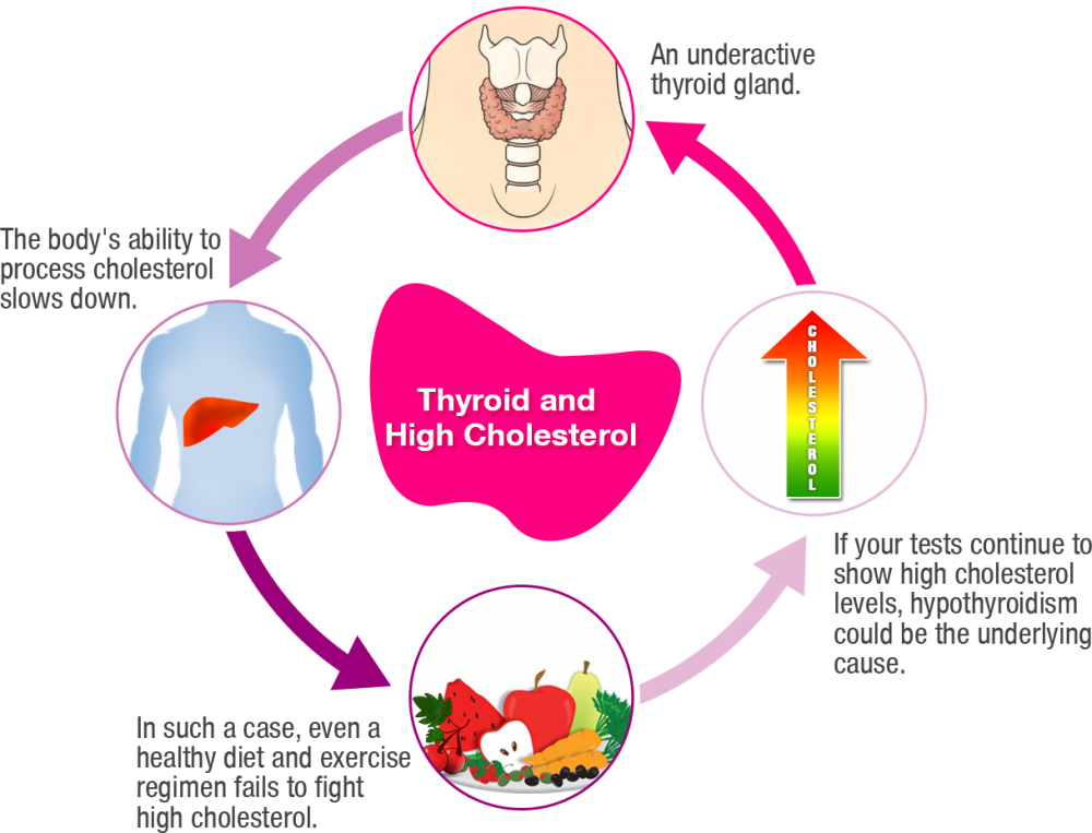 Thyroid Disorder And High Cholesterol - Thyroid Disorder And High Cholesterol (1000x763)