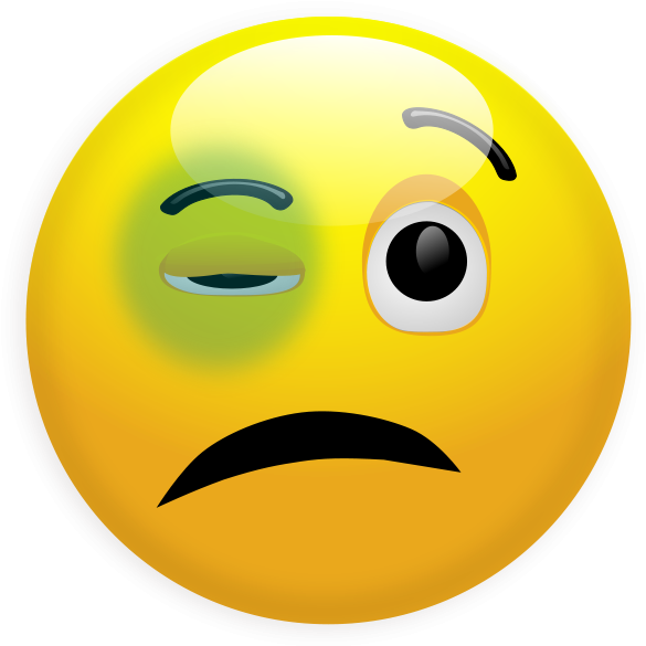 Smile 3 Small Clipart 300pixel Size, Free Design - Smile 3 Small Clipart 300pixel Size, Free Design (599x600)