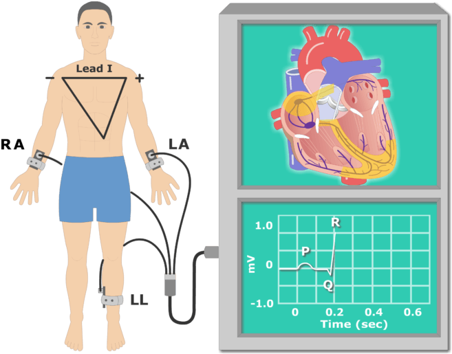 Ecg Cartoon Clipart Electrocardiography The Electrocardiogram - Ecg Cartoon Clipart Electrocardiography The Electrocardiogram (666x550)