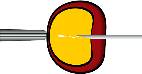 Ivf Success - Ivf Success (500x500)