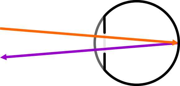 Enter Image Description Here - Enter Image Description Here (580x279)