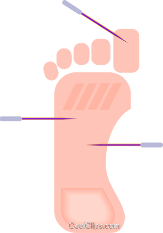 Acupuncture Royalty Free Vector Clip Art Illustration - Acupuncture Royalty Free Vector Clip Art Illustration (336x480)