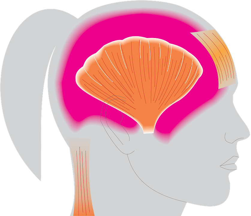 2w2111 Migraines - 2w2111 Migraines (886x720)