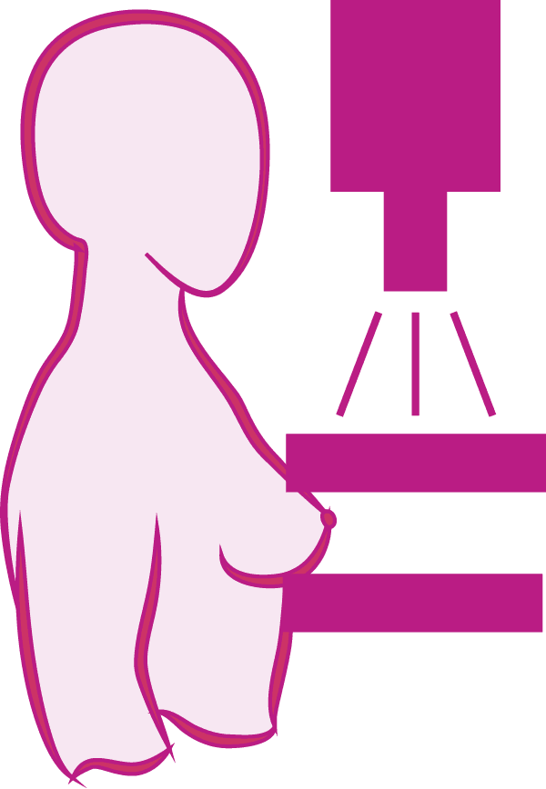 Mammogram - Mammogram (600x868)