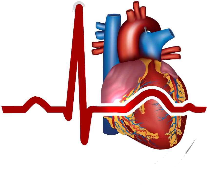 Myocardial Infarction Heart Cardiovascular - Myocardial Infarction Heart Cardiovascular (995x1000)