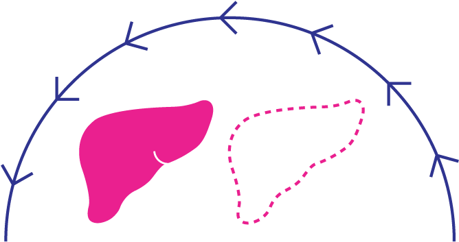 Because Of Its Lack Of Symptoms, Nash Can Be Very Hard - Because Of Its Lack Of Symptoms, Nash Can Be Very Hard (772x450)