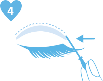 Apply To One Eye At A Time - Apply To One Eye At A Time (415x315)