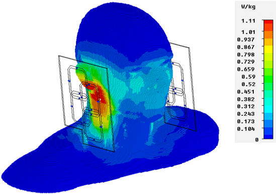 The Primary Concern Is That The Rf Electromagnetic - The Primary Concern Is That The Rf Electromagnetic (573x400)