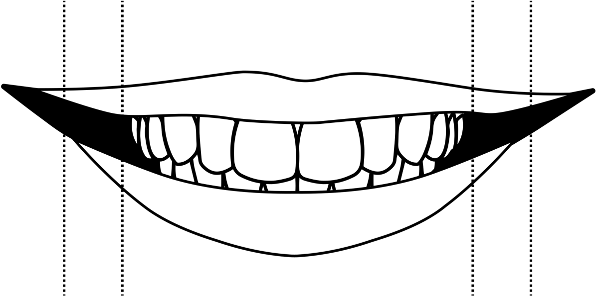 Narrow Smile - Narrow Smile (1200x622)