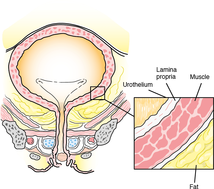 Patient Clipart Kidney Cancer - Patient Clipart Kidney Cancer (829x745)