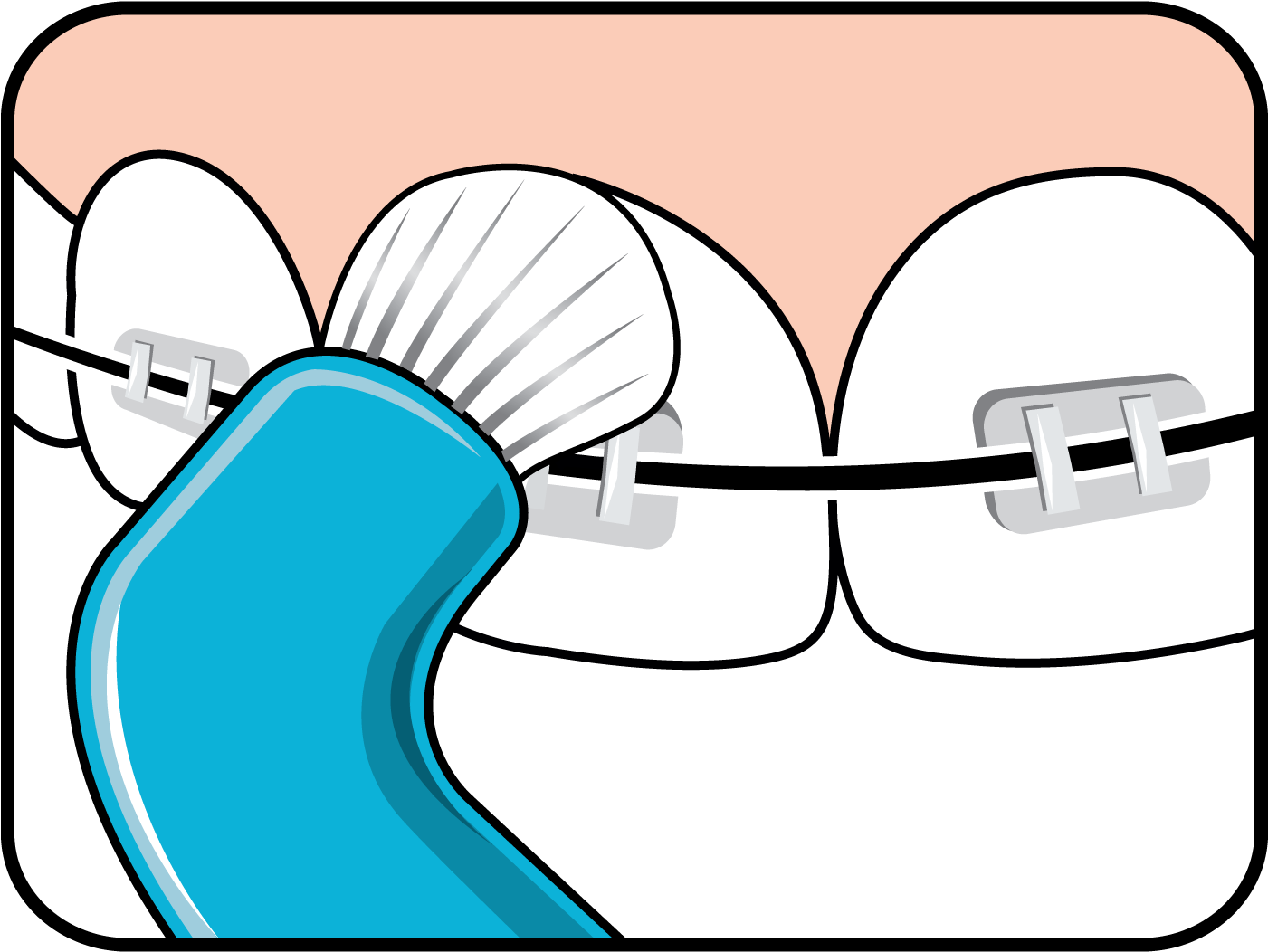 Effective Cleaning Along The Gum Line - Effective Cleaning Along The Gum Line (1500x1500)