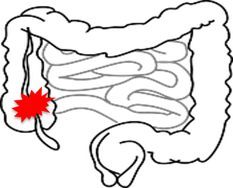 You Are Here - Intestines Clipart (478x387)