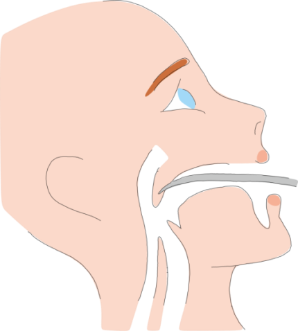 What About Surgery For Snoring - Illustration (430x478)
