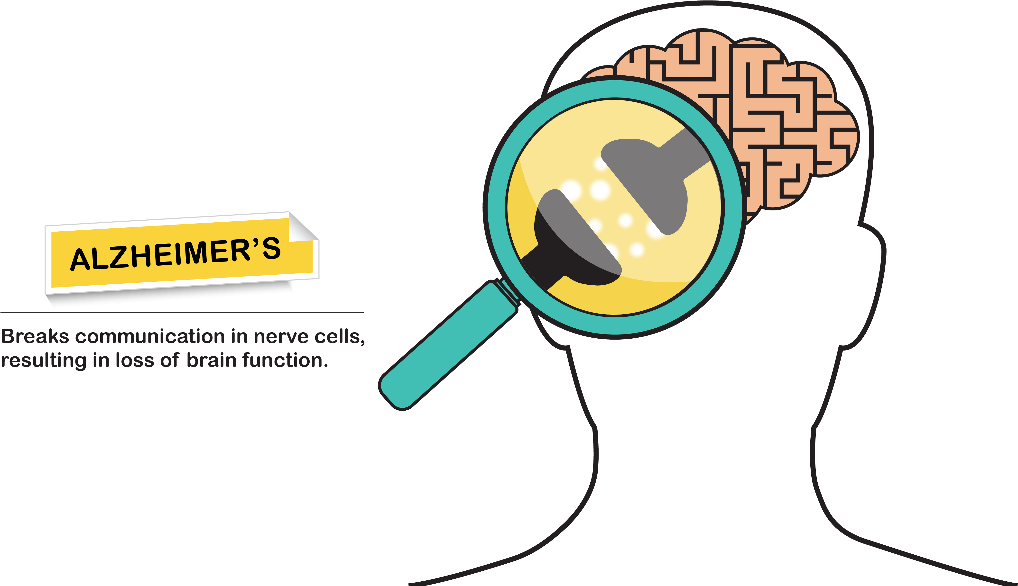 Memories Clipart Alzheimer's Disease Patient - Alzheimer Brain Cartoon (5001x2618)