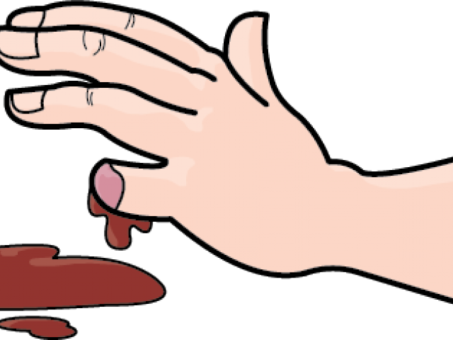 Wound Clipart Bleeding Kansas - Amputation Finger Clipart (640x480)