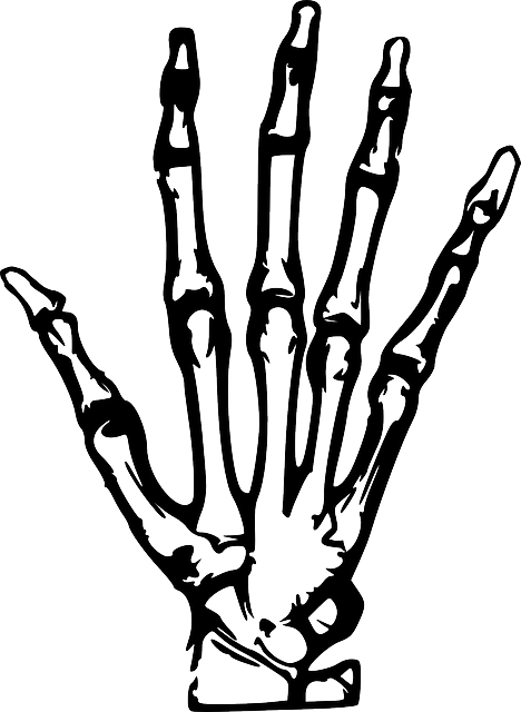 Free Vector Graphic - X Ray Hand Cartoon (468x640)