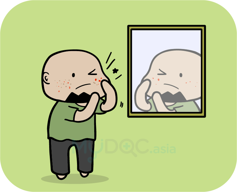 Your 8 Bad Habits That Cause Large Pores On Your Face - Cartoon (800x650)