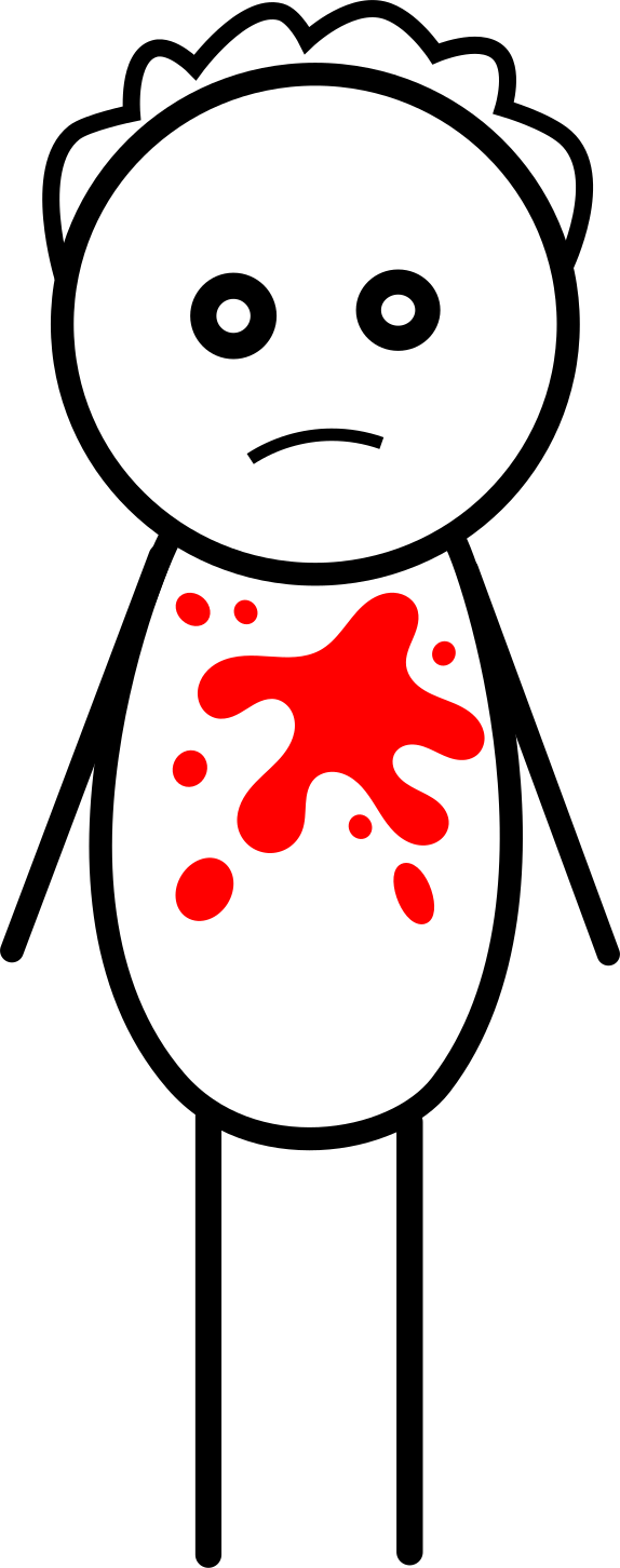 Red Herring As A Type Of Indirect Discourse - Red Herring As A Type Of Indirect Discourse (574x1452)