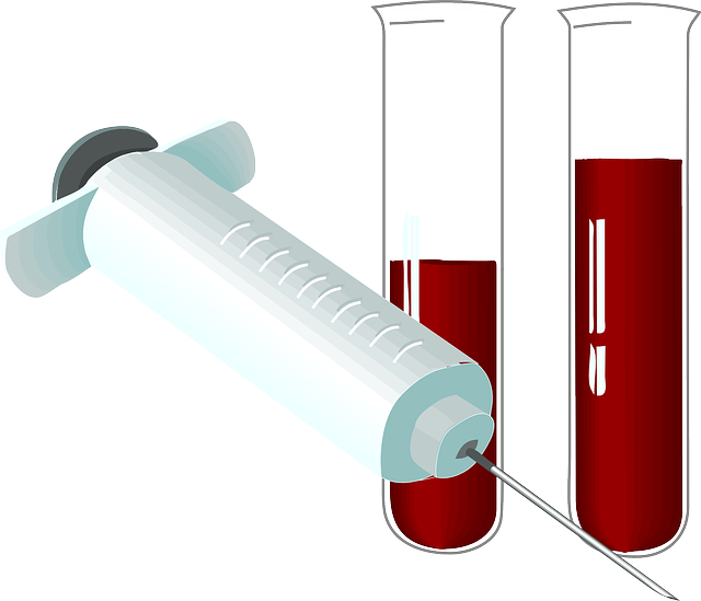 Tubes Lab, Tube, Syringe, Laboratory, Blood, Test, - Blood Test Clip Art (875x750)