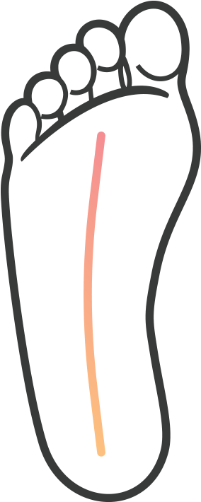 Flat Feet/cavus Feet - Flat Feet/cavus Feet (920x920)